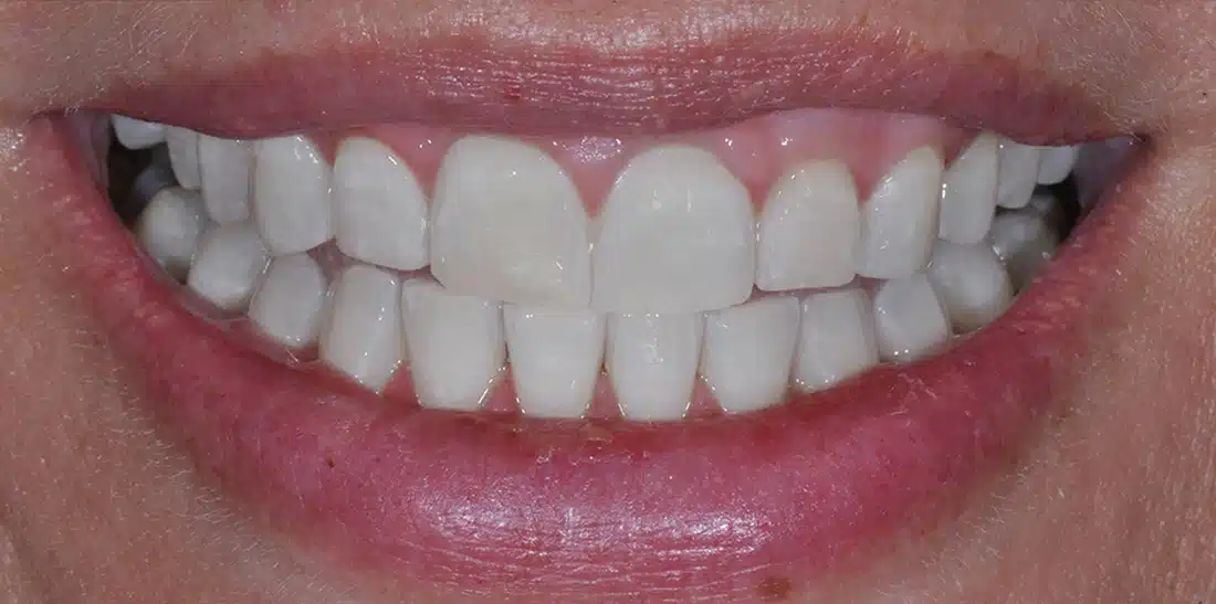 After2, Celestial Dental | General Dentist