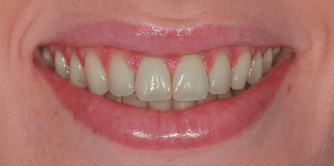 Before1, Celestial Dental | General Dentist