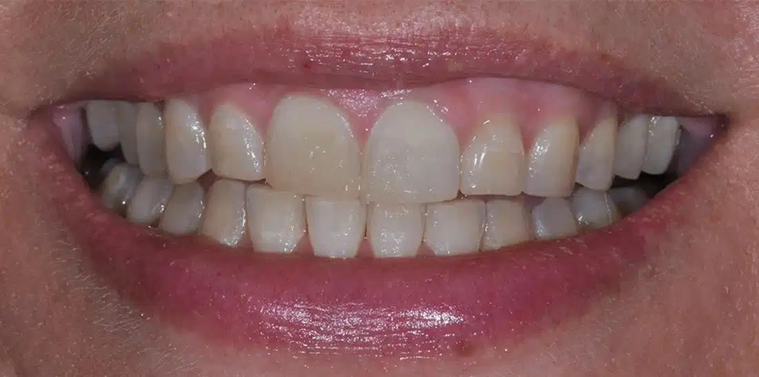 Before2, Celestial Dental | General Dentist