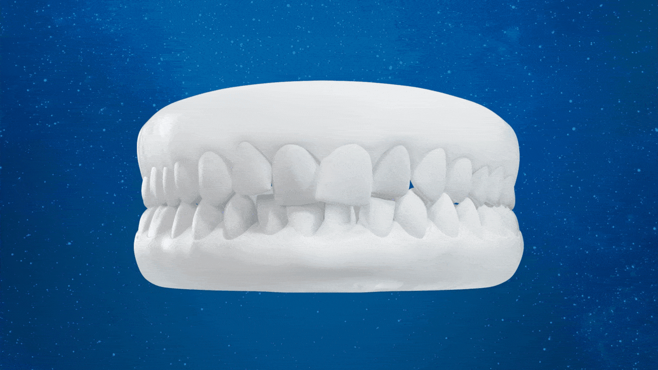 Clear aligners Rochester NY, Orbit Clear Aligners, Celestial Dental | General Dentist