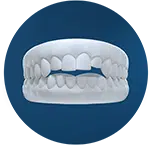 Clear aligners Rochester NY, Orbit Clear Aligners, Celestial Dental | General Dentist